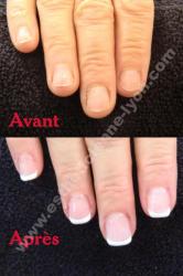 ongle gel avant apres sur ongle cours extension chablon